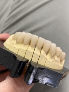 fémkerámia körhíd